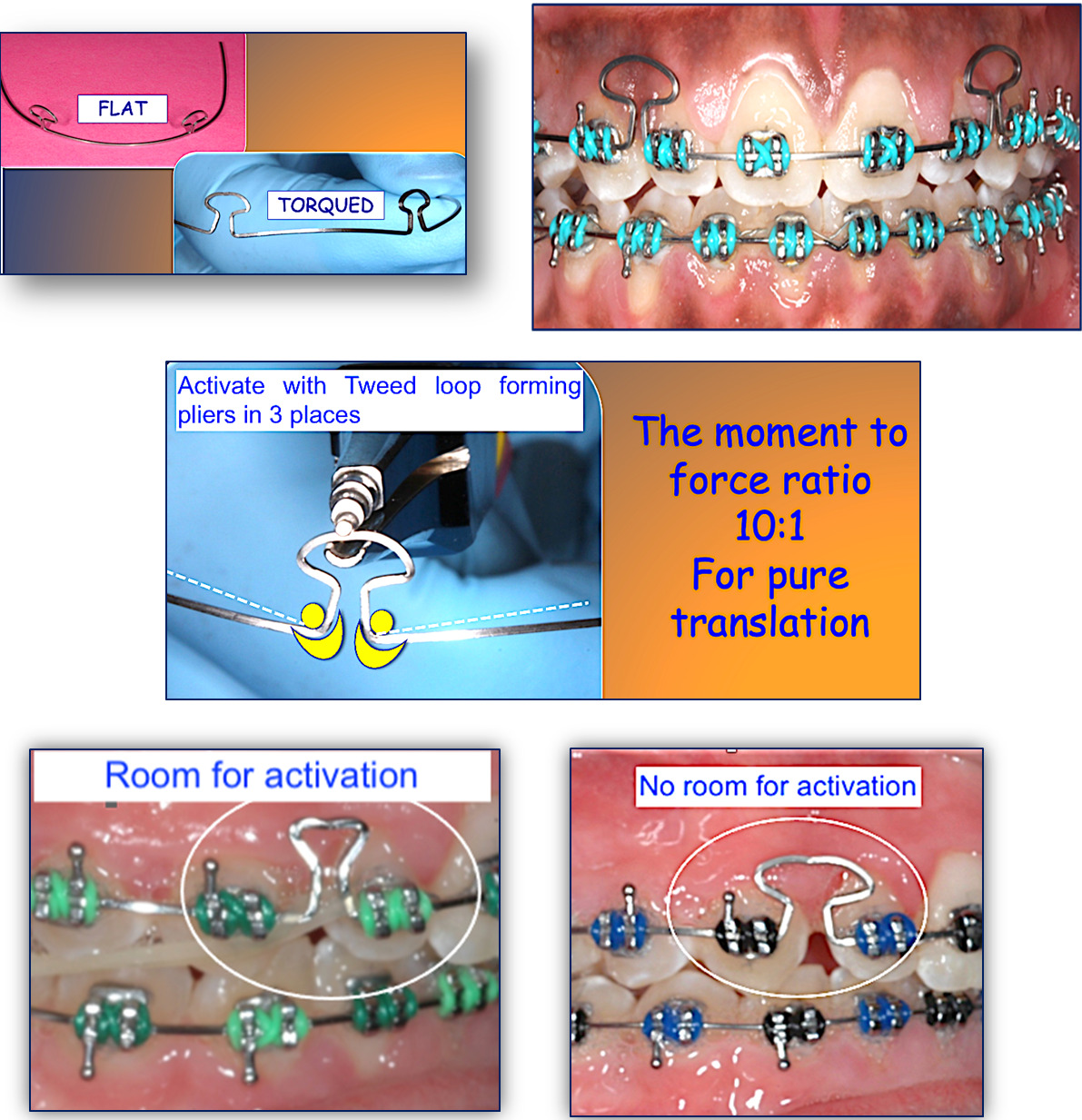 January's Tip Prefabricated Posted and Keyhole/Mushroom Looped Arch WiresWhat is it All About